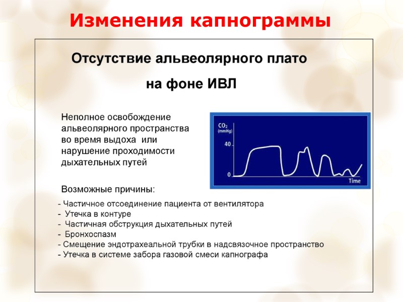 Изменения капнограммы